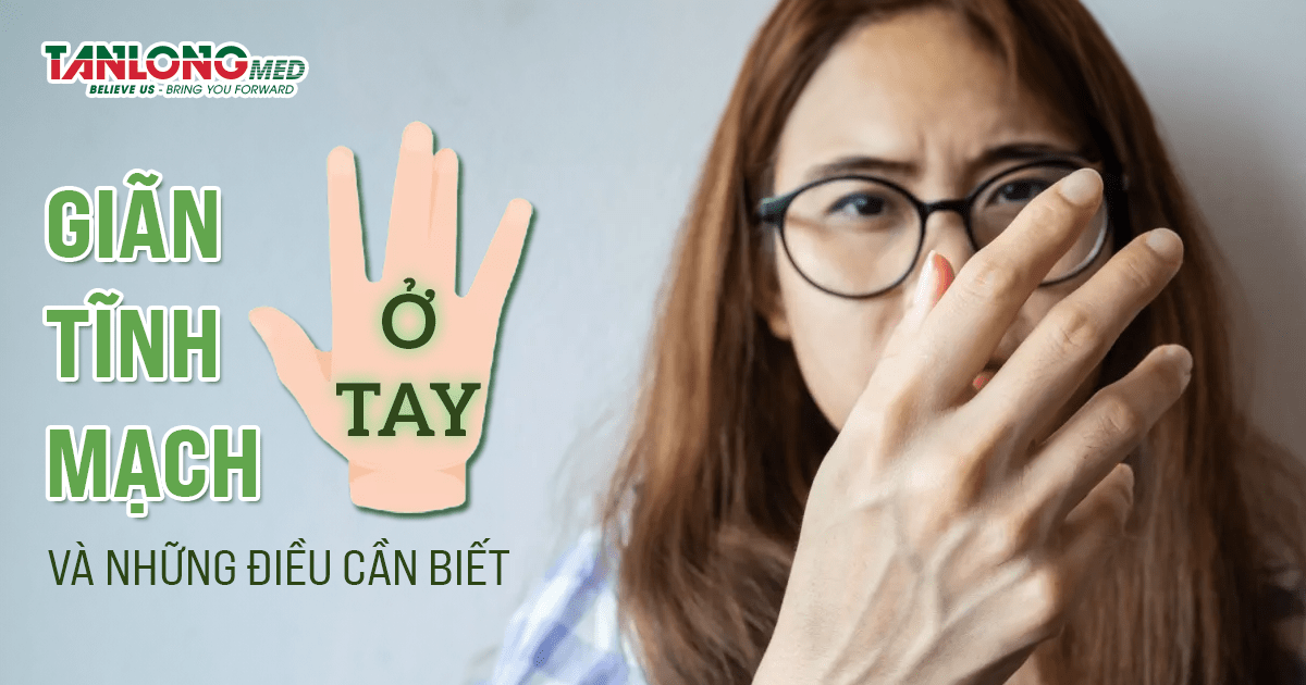 tanlongmed giãn tĩnh mạch ở tay và những điều cần biết